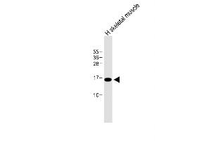 Anti-E Antibody (N-term) at 1:500 dilution + Human skeletal muscle lysate Lysates/proteins at 20 μg per lane.