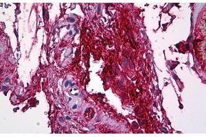 Human Intravascular Plasma: Formalin-Fixed, Paraffin-Embedded (FFPE) (FGG Antikörper  (AA 31-130))