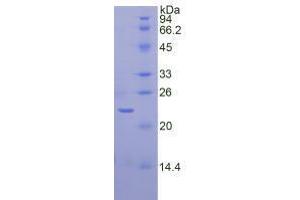 Image no. 1 for Sirtuin 3 (SIRT3) (AA 127-303) (Active) protein (His tag) (ABIN6239975)