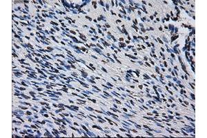 Image no. 3 for anti-Replication Protein A2, 32kDa (RPA2) antibody (ABIN1500735)