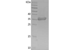 GAPDH Protein (AA 2-335) (His tag)