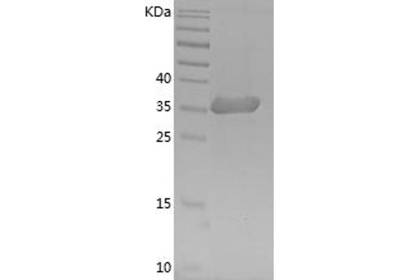 GAPDH Protein (AA 2-335) (His tag)