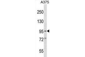 Western Blotting (WB) image for anti-Synapse Defective 1, rho GTPase, Homolog 1 (SYDE1) antibody (ABIN2998825) (SYDE1 Antikörper)