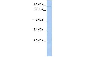 PRKRIR antibody used at 1 ug/ml to detect target protein. (PRKRIR Antikörper)