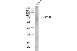 Lane 1: Tev-1 lysates probed with C1orf113 Polyclonal Antibody  at 1:300 overnight at 4˚C.