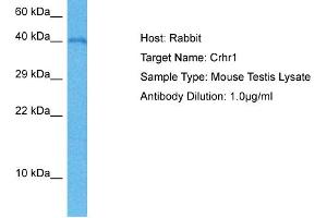 Host: Mouse Target Name: CRHR1 Sample Tissue: Mouse Testis Antibody Dilution: 1ug/ml