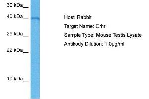 Host: Mouse Target Name: CRHR1 Sample Tissue: Mouse Testis Antibody Dilution: 1ug/ml (CRHR1 Antikörper  (C-Term))
