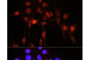 Immunofluorescence analysis of NIH-3T3 cells using Phospho-YAP1(S127) Polyclonal Antibody at dilution of 1:100 (40x lens). (YAP1 Antikörper  (pSer127))