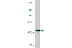 Western Blot detection against Immunogen (37. (PTK7 Antikörper  (AA 36-145))