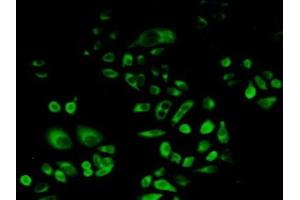 Detection of PSAP in Human Hela Cells using Polyclonal Antibody to Prosaposin (PSAP) (Prosaposin Antikörper  (AA 17-524))