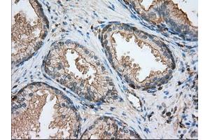 Immunohistochemistry (IHC) image for anti-Aldehyde Dehydrogenase 3 Family, Member A1 (ALDH3A1) antibody (ABIN1496591) (ALDH3A1 Antikörper)