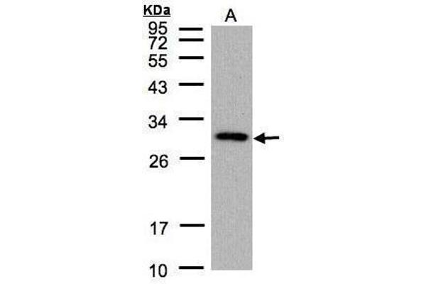 CTDSP2 Antikörper  (Center)