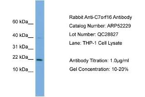 WB Suggested Anti-C7orf16  Antibody Titration: 0. (G Substrate Antikörper  (Middle Region))