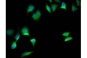 Immunofluorescence staining of Hela Cells with ABIN7127821 at 1:50, counter-stained with DAPI.