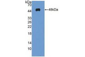 Detection of Recombinant MAX, Human using Polyclonal Antibody to MYC Associated Factor X (MAX) (MAX Antikörper  (AA 2-160))