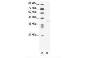 Image no. 1 for anti-Somatostatin Receptor 4 (SSTR4) (AA 163-212) antibody (ABIN202399) (SSTR4 Antikörper  (AA 163-212))