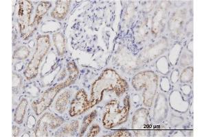 Immunoperoxidase of monoclonal antibody to AMBP on formalin-fixed paraffin-embedded human kidney. (AMBP Antikörper)