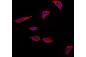 ABIN6263791 and ABIN6273277 staining Hela by IF/ICC.