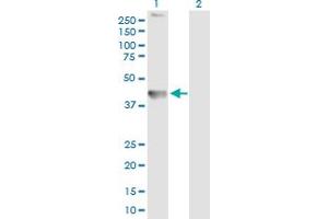 Western Blot analysis of TMEM49 expression in transfected 293T cell line by TMEM49 MaxPab polyclonal antibody. (VMP1 Antikörper  (AA 1-406))