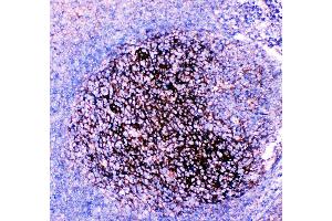 Anti-CD82 Picoband antibody, IHC(P) IHC(P): Human Tonsil Tissue (CD82 Antikörper  (AA 98-267))
