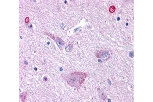 Anti-GPR50 antibody  ABIN1049060 IHC staining of human brain, hypothalamus. (GPR50 Antikörper  (Cytoplasmic Domain))
