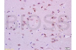 Formalin-fixed and paraffin embedded rat brain labeled with Anti-5-HTR1A/HTR1A Polyclonal Antibody, Unconjugated (ABIN738006) at 1:200 followed by conjugation to the secondary antibody and DAB staining. (Serotonin Receptor 1A Antikörper  (AA 301-400))