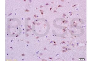 Formalin-fixed and paraffin embedded rat brain labeled with Anti-5-HTR1A/HTR1A Polyclonal Antibody, Unconjugated (ABIN738006) at 1:200 followed by conjugation to the secondary antibody and DAB staining.