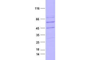 Western Blotting (WB) image for Neurotrophic tyrosine Kinase, Receptor, Type 3 (NTRK3) protein (DYKDDDDK Tag) (ABIN2734344)