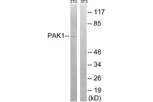 Western blot analysis of extracts from 3T3 cells, treated with UV (15mins), using PAK1 (epitope around residue 204) antibody. (PAK1 Antikörper  (Ser204))