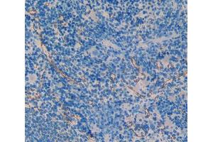 IHC-P analysis of spleen tissue, with DAB staining. (SMAD1 Antikörper  (AA 273-468))