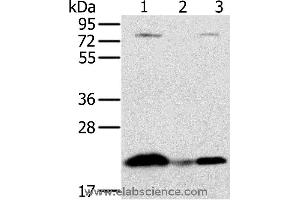 Western blot analysis of Raji cell and human liver cancer tissue, hela cell, using NDUFAF2 Polyclonal Antibody at dilution of 1:250 (NDUFAF2 Antikörper)