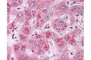 Immunohistochemistry (IHC) image for anti-Wingless-Type MMTV Integration Site Family, Member 11 (WNT11) (Internal Region) antibody (ABIN1049471)
