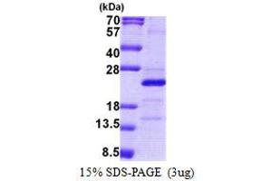 SDS-PAGE (SDS) image for Mitochondrial Ribosomal Protein S25 (MRPS25) (AA 1-173) protein (His tag) (ABIN5853099) (MRPS25 Protein (AA 1-173) (His tag))