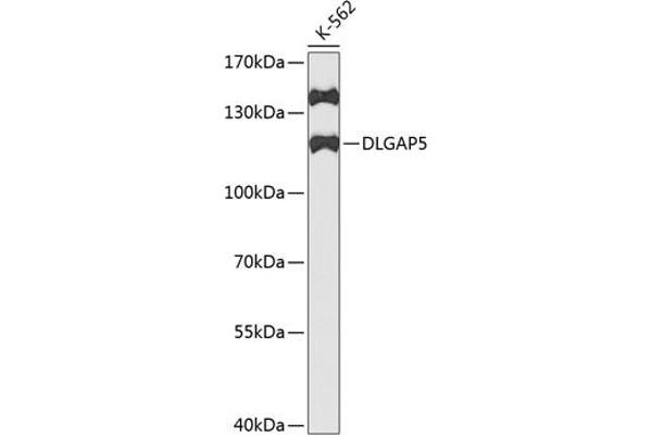 DLGAP5 Antikörper  (AA 547-846)