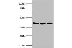Western blot All lanes: ADP-ribosylation factor GTPase-activating protein 1 antibody at 8 μg/mL Lane 1: PC-3 whole cell lysate Lane 2: Hela whole cell lysate Lane 3: Mouse brain tissue Secondary Goat polyclonal to rabbit IgG at 1/10000 dilution Predicted band size: 45, 46, 32, 40 kDa Observed band size: 45 kDa (ARFGAP1 Antikörper  (AA 1-220))