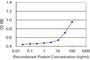 MCAT (Human) Matched Antibody Pair