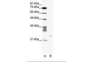 Image no. 1 for anti-BCL2-Related Protein A1 (BCL2A1) (C-Term) antibody (ABIN6736048) (BCL2A1 Antikörper  (C-Term))