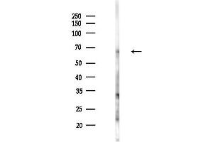 Western blot analysis of lysates from Mouse lung, using Serotonin transporter Antibody at 1/1000 dilution.