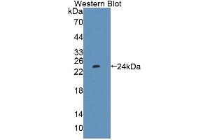 Figure. (PTP4A1 Antikörper  (AA 1-173))