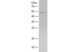 Western Blotting (WB) image for Mitochondrial Ribosomal Protein S18B (MRPS18B) (AA 1-258) protein (His-IF2DI Tag) (ABIN7284105) (MRPS18B Protein (AA 1-258) (His-IF2DI Tag))