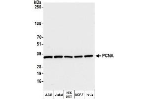 Western Blotting (WB) image for anti-Proliferating Cell Nuclear Antigen (PCNA) (C-Term) antibody (ABIN7455223)