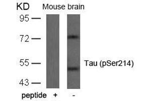 Western blot analysis of extracts from mouse brain tissue using Tau(Phospho-Ser214) Antibody and the same antibody preincubated with blocking peptide. (MAPT Antikörper  (pSer214))
