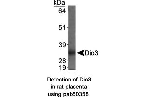 Image no. 1 for anti-Deiodinase, Iodothyronine, Type III (DIO3) (AA 250-300) antibody (ABIN363667) (DIO3 Antikörper  (AA 250-300))