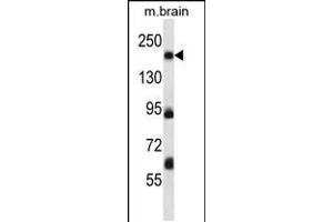 Western blot analysis in mouse brain tissue lysates (35ug/lane). (MAP4K4 Antikörper  (AA 506-534))