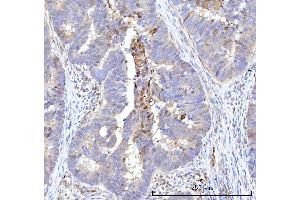 IHC analysis of RBP1 using anti-RBP1 antibody (ABIN7599586). (RBP1 Antikörper  (AA 10-135))