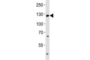 Western blot analysis of lysate from LNCaP cell line using TRPM8 antibody at 1:1000. (TRPM8 Antikörper  (AA 263-292))