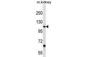 Western Blotting (WB) image for anti-Prostaglandin F2 Receptor Negative Regulator (PTGFRN) antibody (ABIN3000257) (PTGFRN Antikörper)