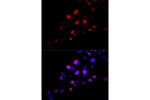 Immunofluorescence analysis of U2OS cells using Rad18 antibody (ABIN6128609, ABIN6146628, ABIN6146630 and ABIN6217430). (RAD18 Antikörper  (AA 216-495))