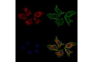 ABIN6262100 and ABIN6268913 staining Hela cells by IF/ICC. (GRP78 Antikörper  (C-Term))