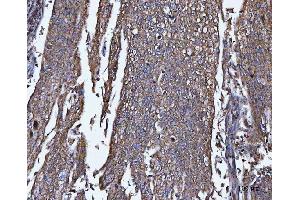 IHC analysis of TRPM4 using anti-TRPM4 antibody (ABIN3044557).